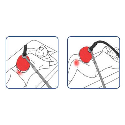 Diathermy treatment system