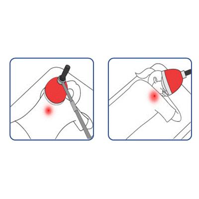Diathermy treatment system